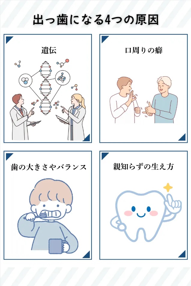 出っ歯_マウスピース矯正_原因