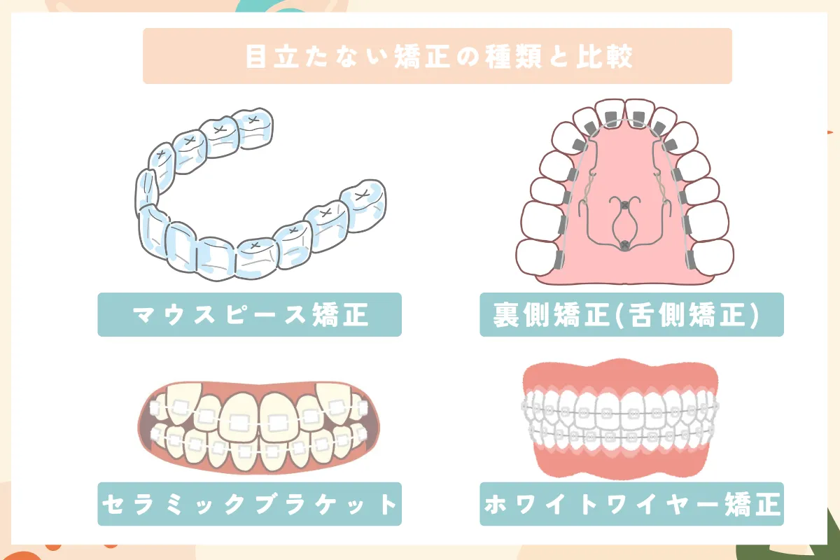 目立たない矯正_種類一覧